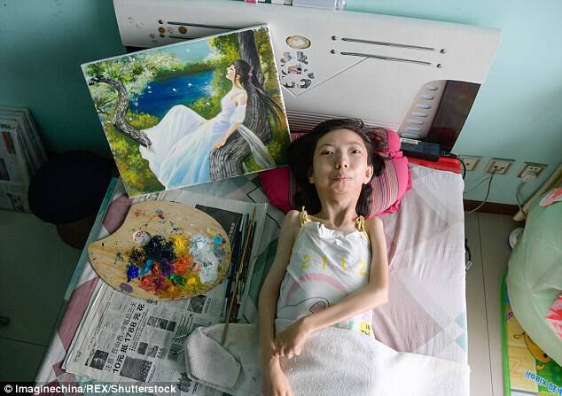 For 32 years, Zhang has been battling rheumatoid arthritis in bed - but never once did she feel sorry for herself. She indulged herself in oil painting and let her imagination run wild
